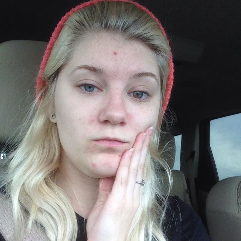 Meet your Posher, Zombyz attack